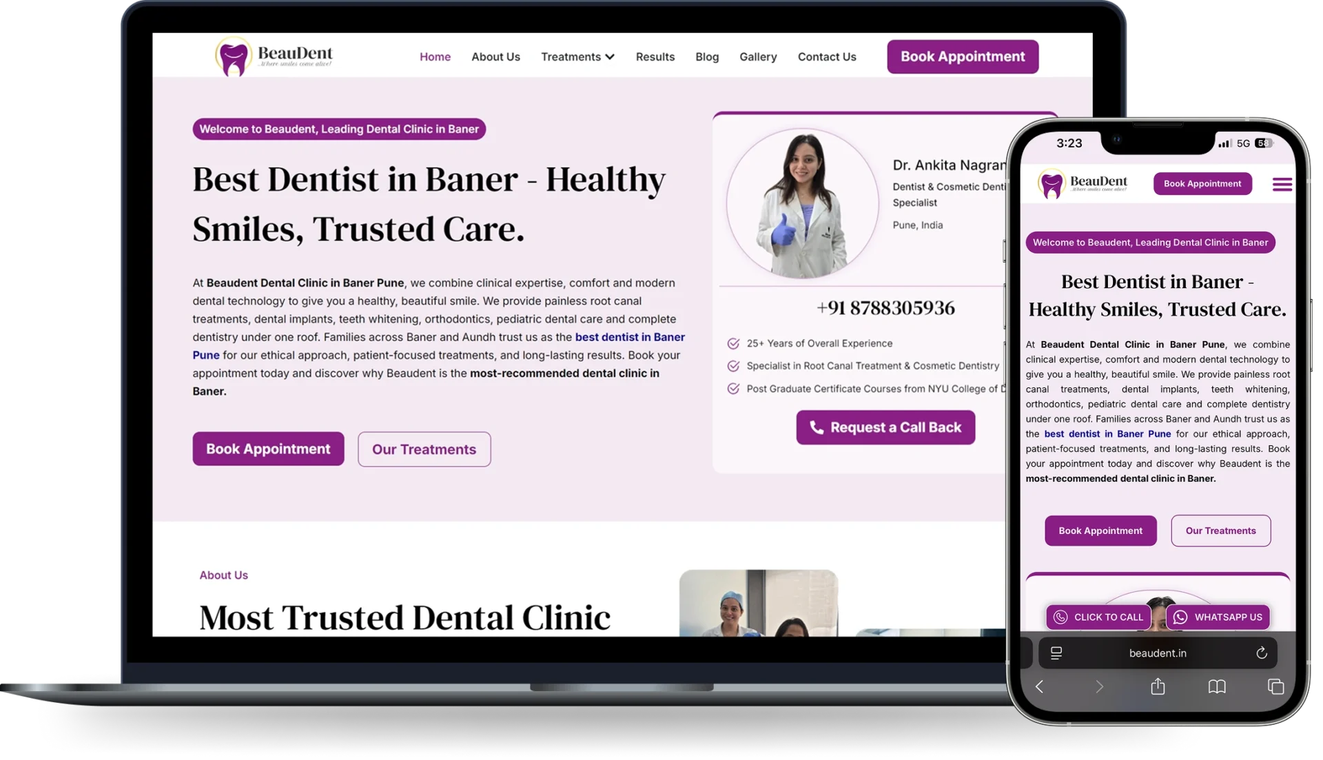 Website Development for Dental Clinic in Pune BeauDent